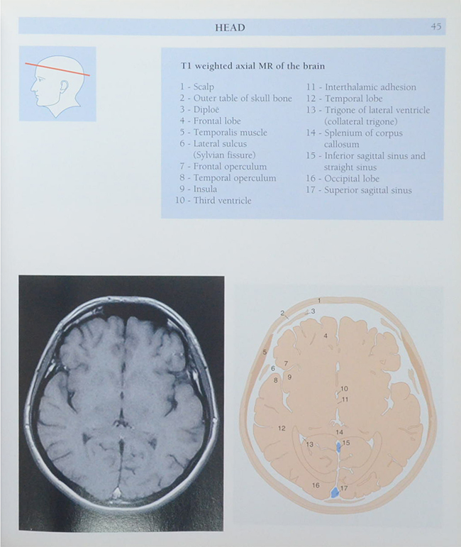 Anatomy of the Living Human ATLAS OF MEDICAL IMAGING