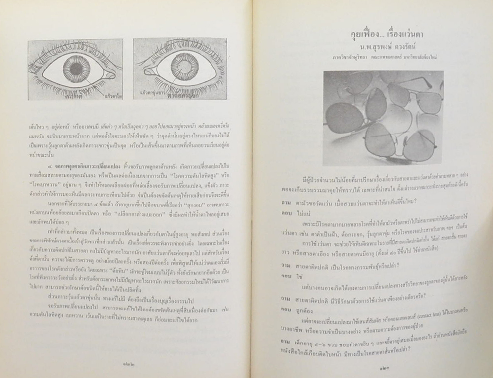 พลตำรวจตรี สิริ ปานประทีป (โรคของตา)