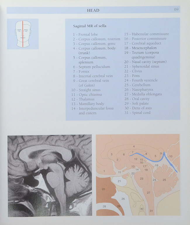 Anatomy of the Living Human ATLAS OF MEDICAL IMAGING