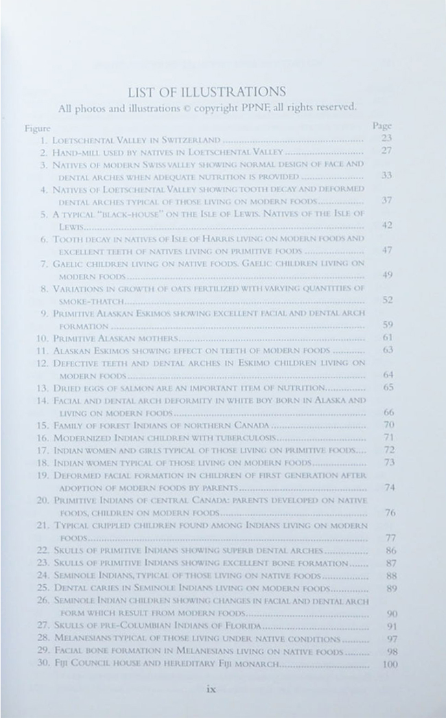 Nutrition and Physical Degeneration