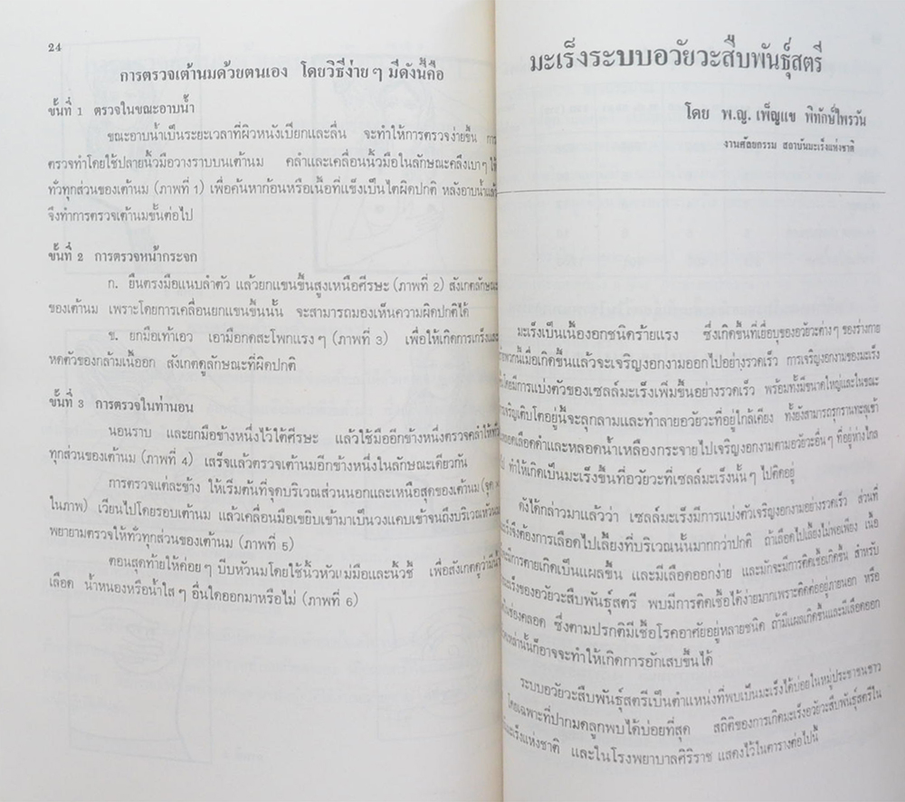 คุณแม่มณฑา นพเกตุ (ความรูทั่วไปเกี่ยวกับโรคมะเร็ง)