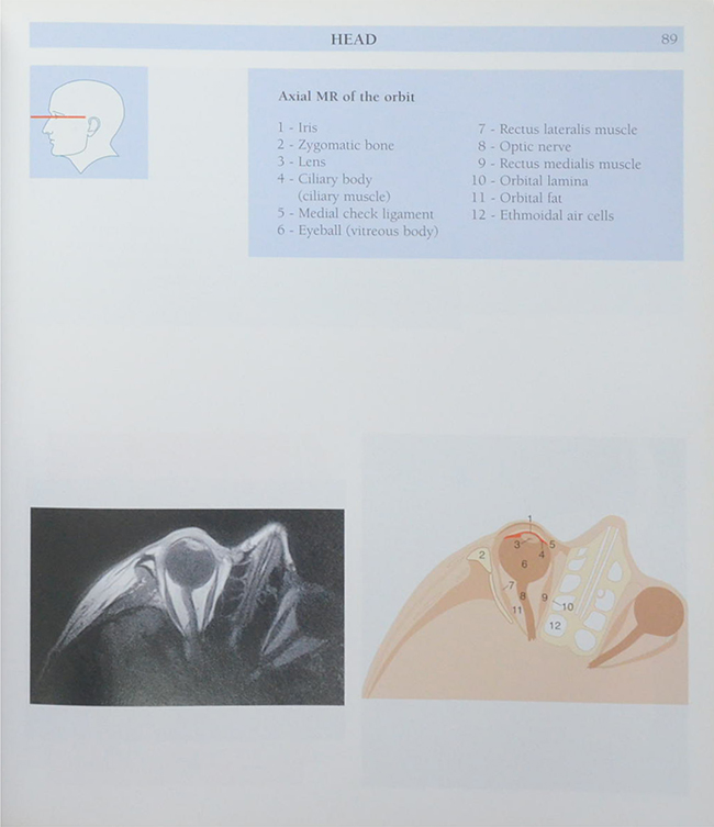 Anatomy of the Living Human ATLAS OF MEDICAL IMAGING