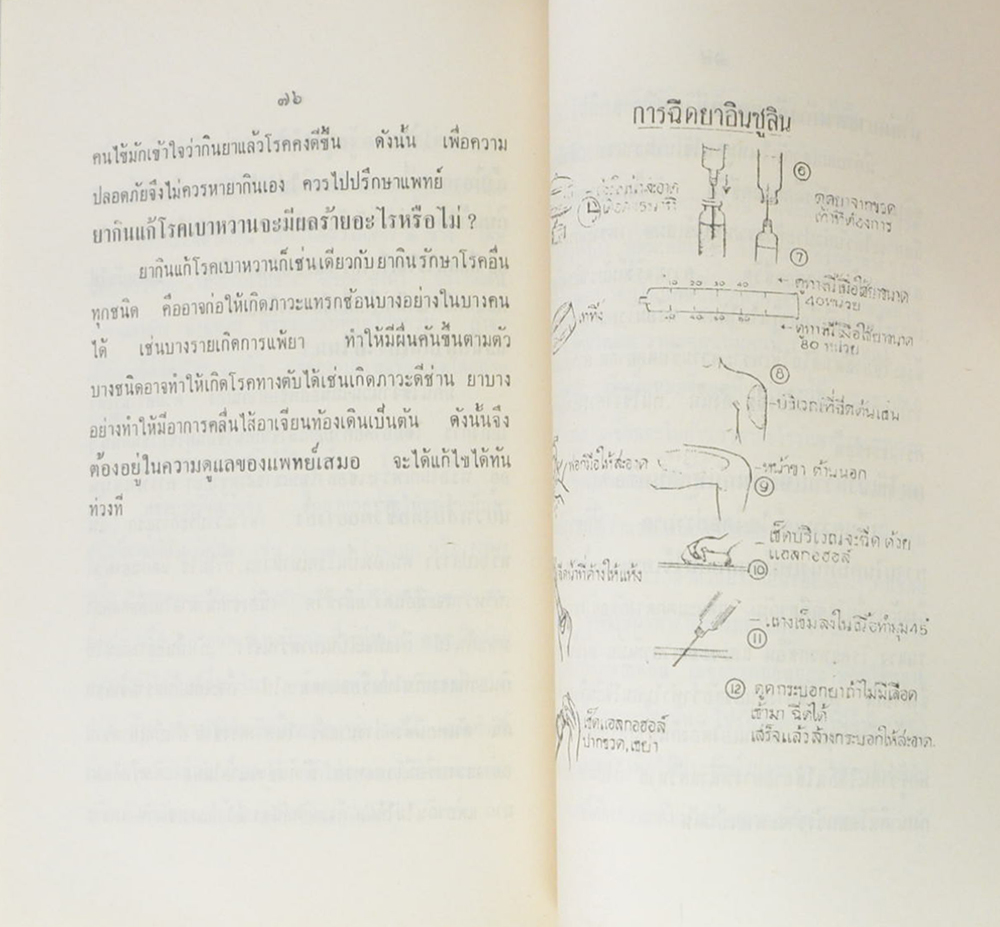 เรื่องโรคเบาหวาน