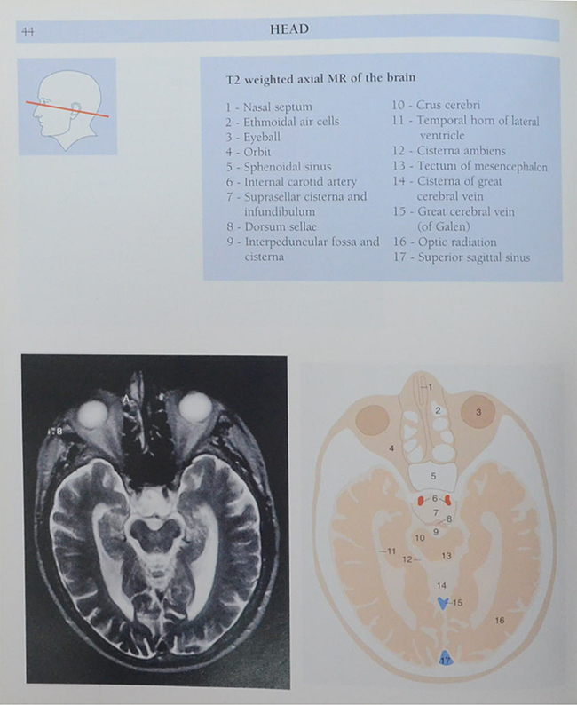 Anatomy of the Living Human ATLAS OF MEDICAL IMAGING
