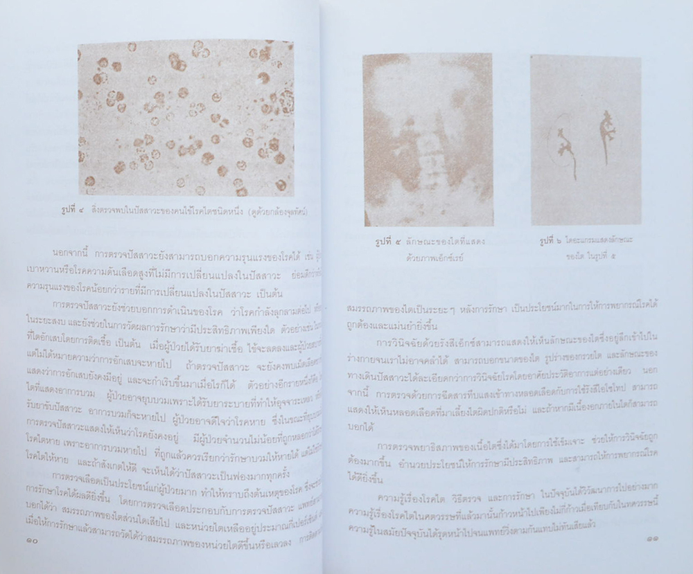 นางจิ้มลิ้ม พูลสวัสดิ์ (ความรู้เรื่องโรคไตสำหรับประชาชน)