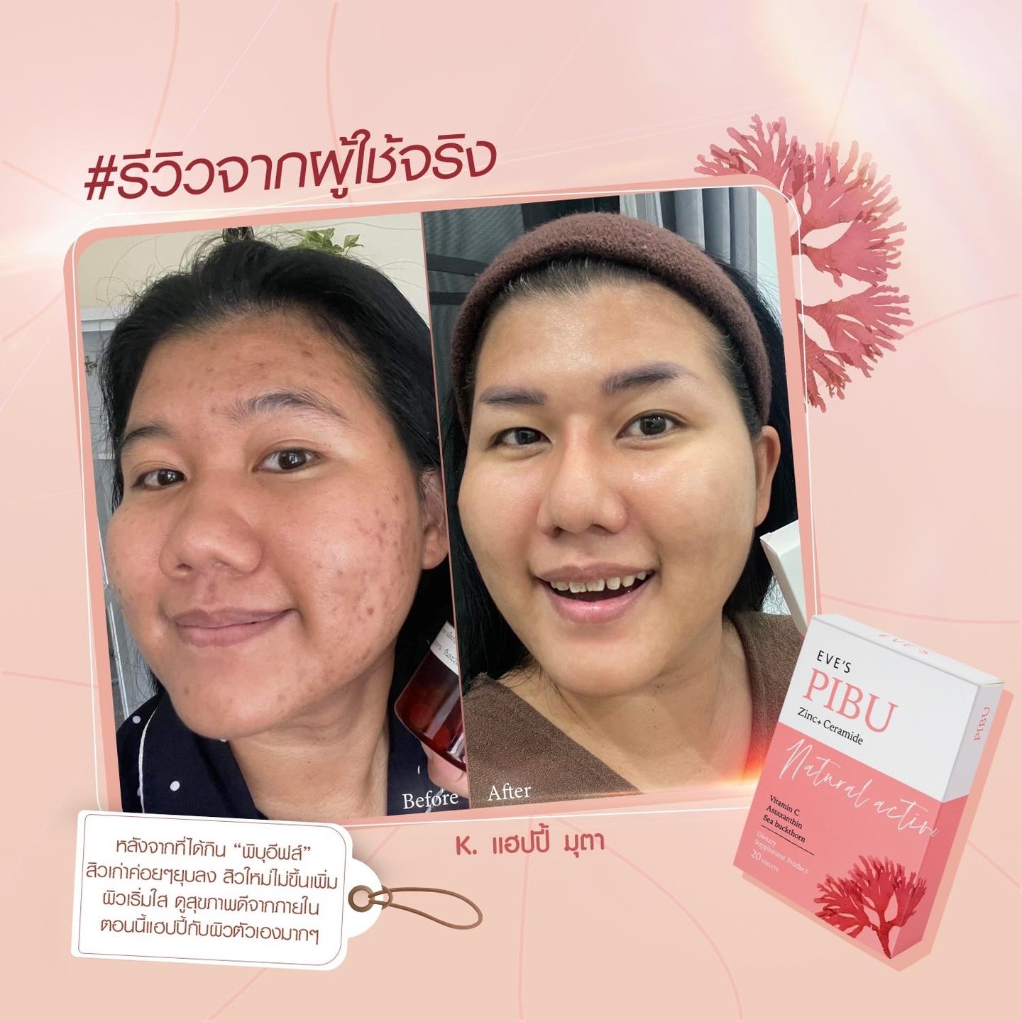 EVE'S PIBU พิบุอีฟส์ ผิวขาวใส ไร้สิว เสริมสร้างภูมิต้านทานให้ร่างกาย