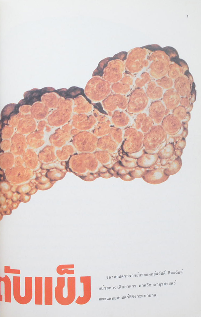 ชุมพล มุขดาร์ (โรคดีซ่าน)