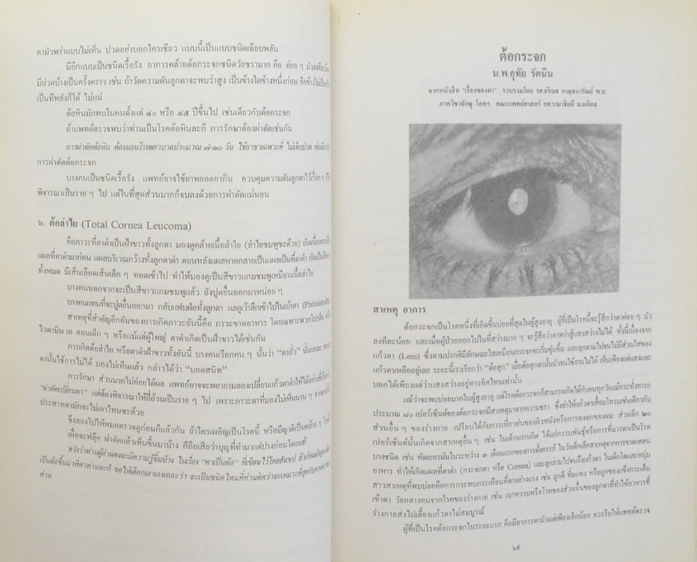 พลตำรวจตรี สิริ ปานประทีป (โรคของตา)