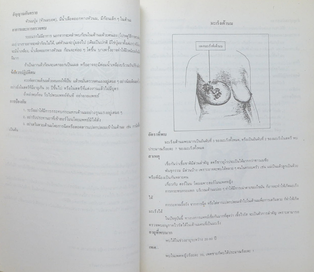 นายบรรยง ลิ้มจำรูญ (ความรู้เรื่องโรคมะเร็ง)
