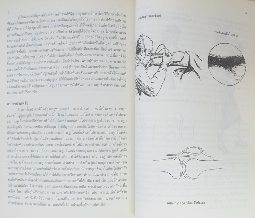 ขุนฉันทศาสตร์โกศล (ปัญหาเรื่องกระดูกและข้อในคนสูงอายุ อุบัติเหตุในผู้สูงอายุและวิธีป้องกัน)