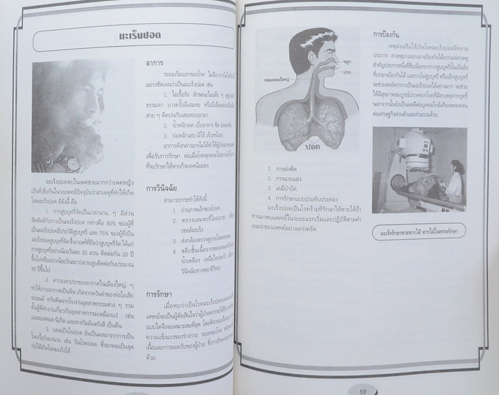 นางประจวบ พรหมจาต (ความรู้เรื่องโรคมะเร็ง)