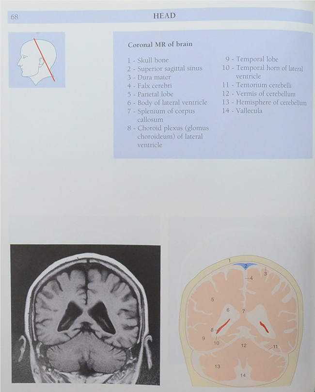 Anatomy of the Living Human ATLAS OF MEDICAL IMAGING
