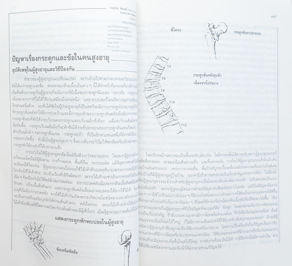 นางจรัล อุตตะโมต (ปัญหาเรื่องกระดูกและข้อในคนสูงอายุ)