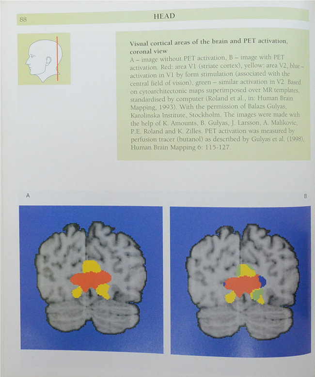Anatomy of the Living Human ATLAS OF MEDICAL IMAGING
