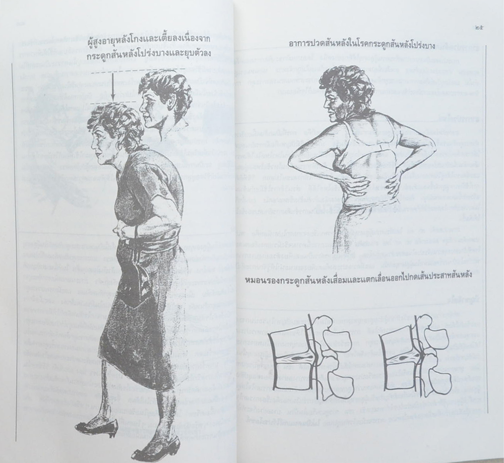 นางจรัล อุตตะโมต (ปัญหาเรื่องกระดูกและข้อในคนสูงอายุ)