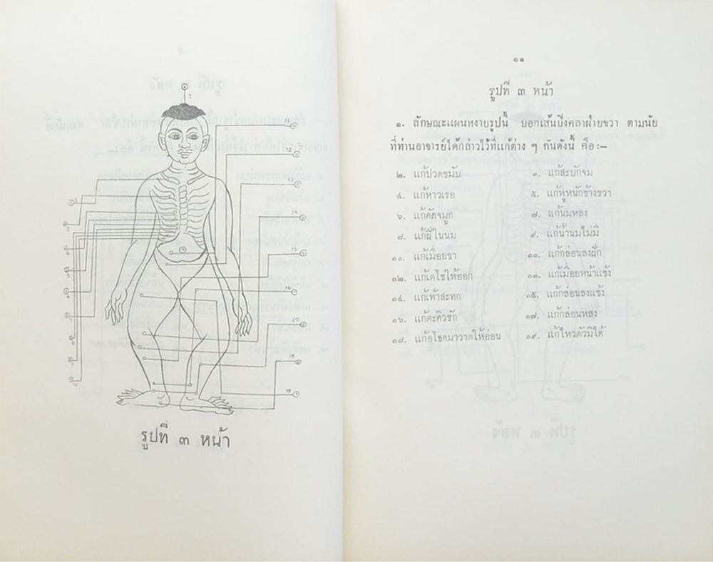 ตำรายา ศิลาจารึกในวัดพระเชตุพนวิมลมังคลาราม (วัดโพธิ์)พระนคร