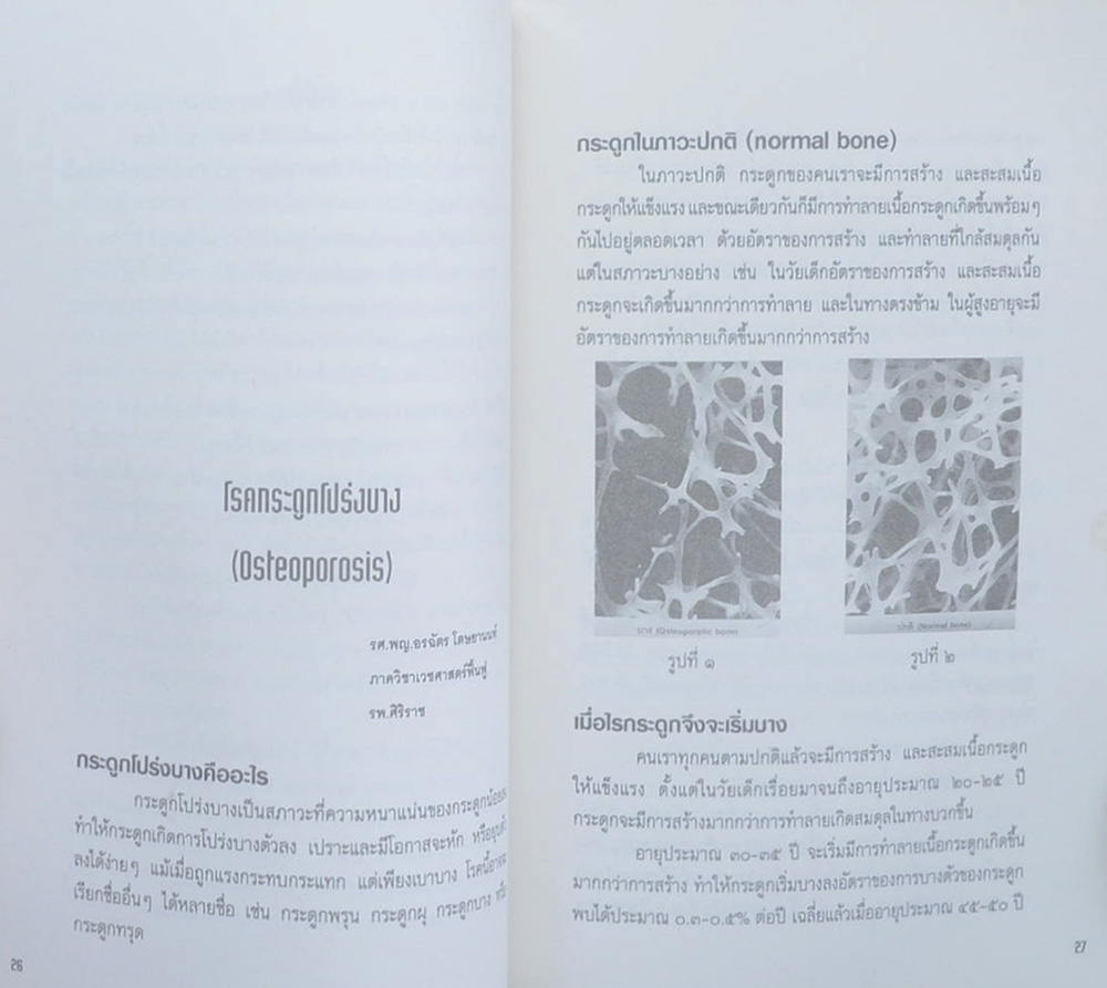 นายศรีสวัสดิ์ โตษยานนท์ (โรคกระดูกโปร่งบาง)