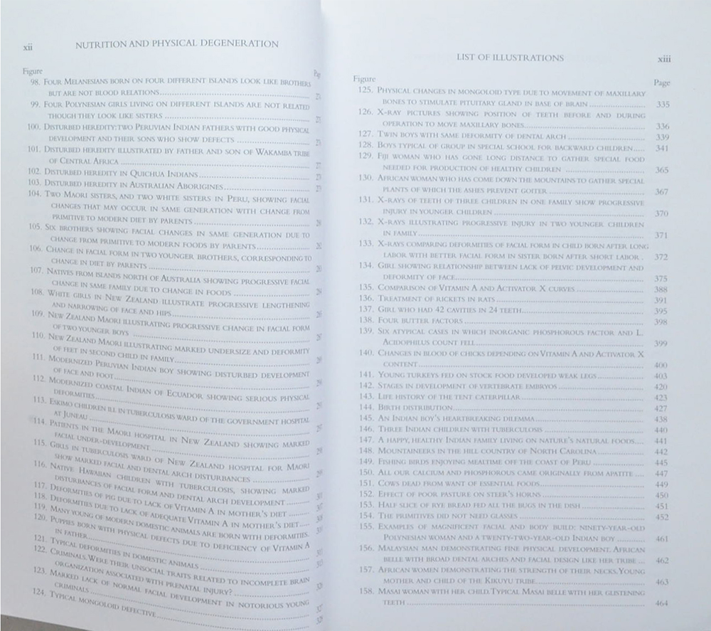 Nutrition and Physical Degeneration