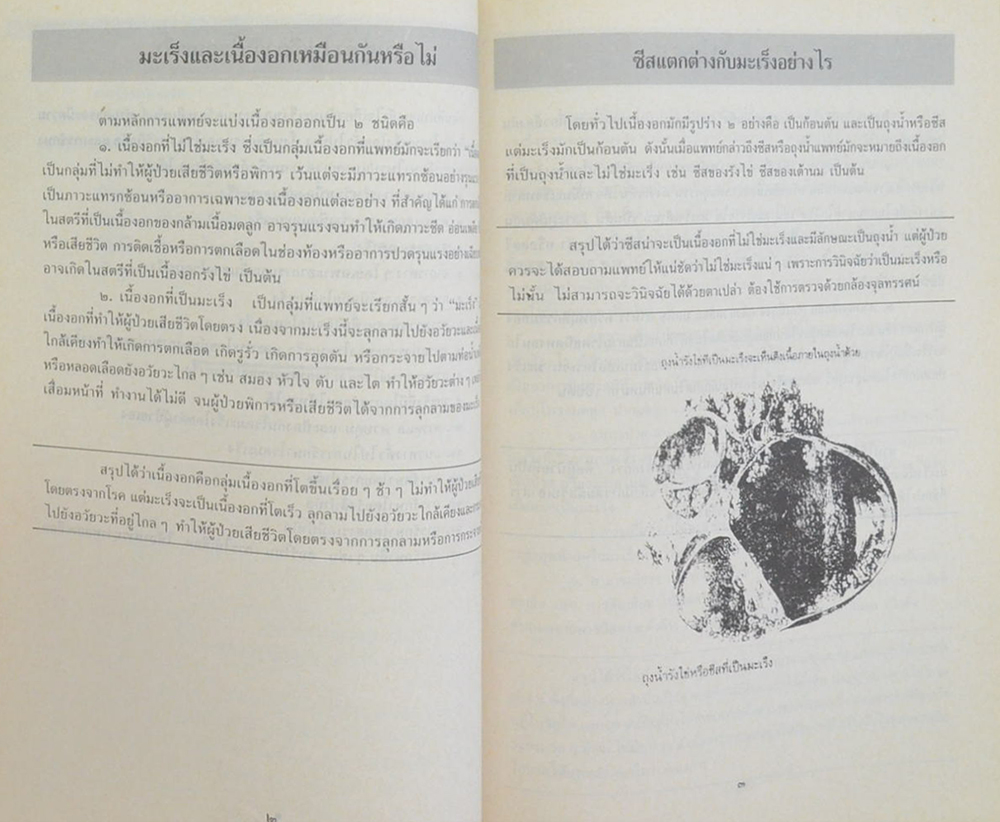 นางวัชรี รัตนมุง (108 คำถาม มะเร็งในตรี การป้องกัน ควบคุม และรักษาด้วยตนเอง)