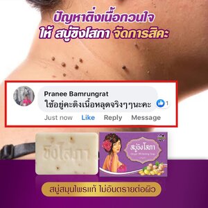 รีวิวจากผู้ใช้งานจริง สบู่ขิงโสภา ใช้ดีไหม